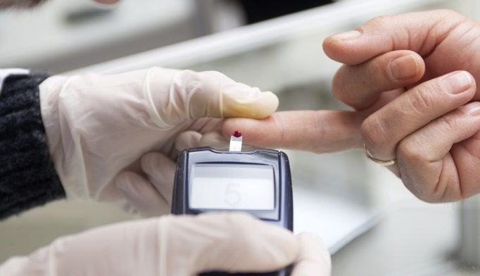 Insulin Resistance Blood Tests: The Early Warning Signs of Metabolic Dysfunction