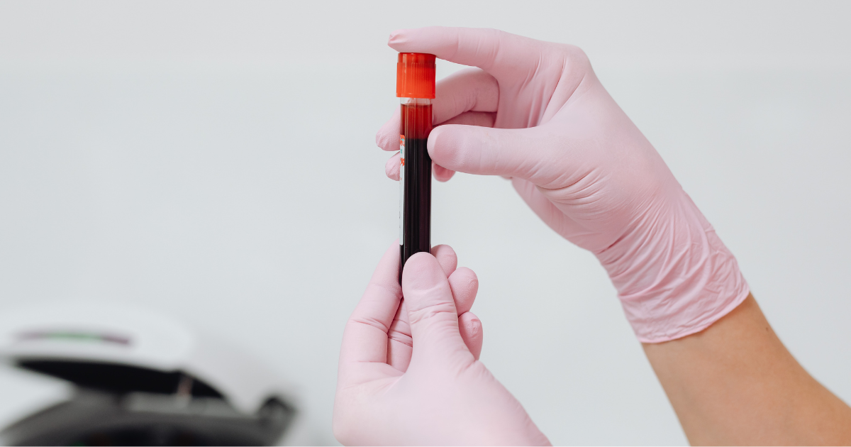 Male Hormone Panel Blood Test: What to Check Before Starting TRT